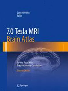 Tesla MRI Brain Atlas: In-vivo Atlas With Cryomacrotome Correlation