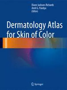 9783642544453 Dermatology Atlas for Skin of Color