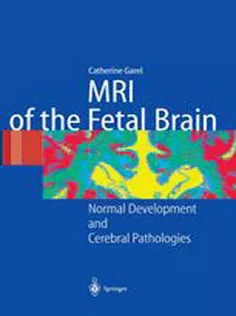 MRI of the Fetal Brain