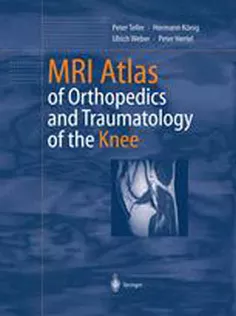 MRI Atlas of Orthopedics and Traumatology of the Knee