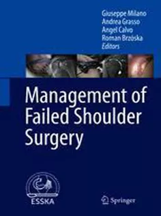 9783662565032 Management of Failed Shoulder Surgery