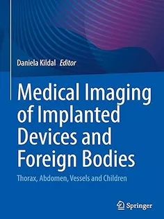 Medical Imaging of Implanted Devices and Foreign Bodies: Head, Extremities and Spine
