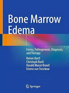Bone Marrow Edema: Forms, Pathogenesis, Diagnosis, and Therapy