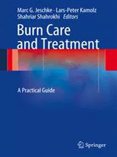 Burn Care and Treatment: A Practical Guide1