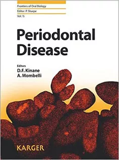 Periodontal Disease
