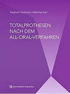 Totalprothesen Nach Dem All-Oral-Verfahren