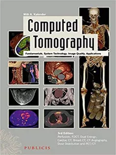 Computed Tomography