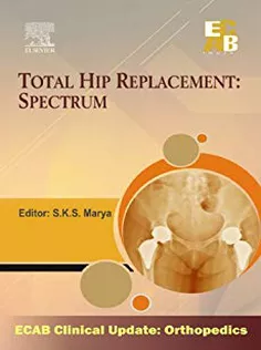 Total Hip Replacement Spectrum