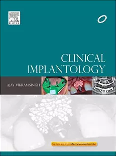 Clinical Implantology