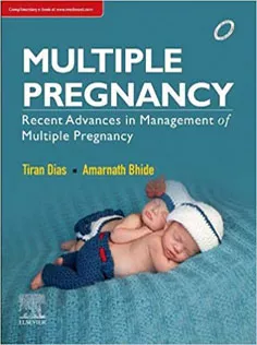 Multiple Pregnancy