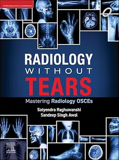 Radiology Without Tears- E-Book: Mastering Radiology OSCEs