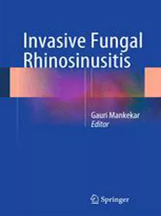 9788132215295 Invasive Fungal Rhinosinusitis