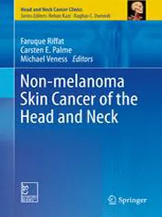 9788132224969 Non-melanoma Skin Cancer of the Head and Neck