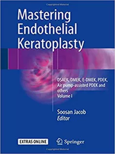 Mastering Endothelial Keratoplasty: Volume I