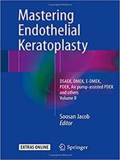Mastering Endothelial Keratoplasty: Volume II