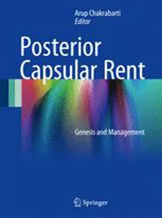 9788132235842 Posterior Capsular Rent: Genesis and Management