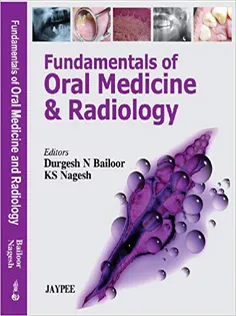 Fundamentals of Oral Medicine and Radiology