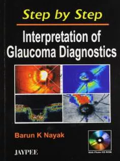 Step by Step Interpreattion of Glaucoma