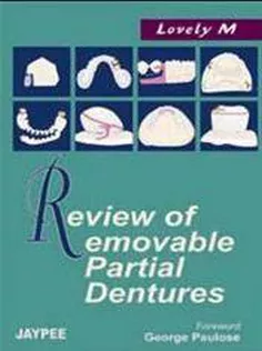 Review of Removable Partial Dentures