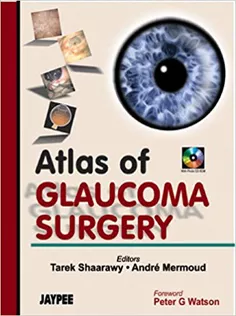 Atlas of Glaucoma Surgery