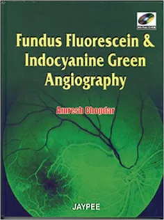 Fundus Fluorescein and Indocyanine Green Angiography