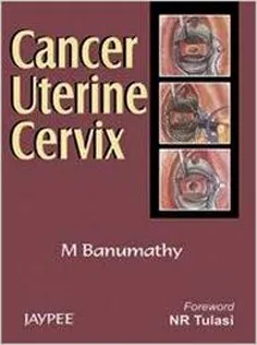 Cancer Uterine Cervix 2007