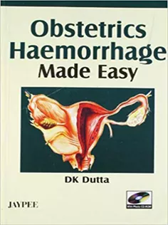 Obstetrics Haemorrhage Made Easy