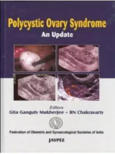 Polycystic Ovary Syndrome An Update