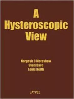 A Hysteroscopy View