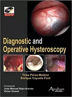 Diagnostic and Operative Hysteroscopy1