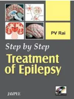 Step by Step Treatment of Epilepsy