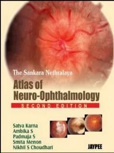 The Sankara Nethralaya Atlas of Neuro-Ophthalmology
