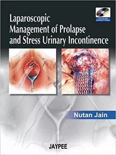 Laparoscopic Management Of Prolapse And Stress Urinary Incontinence