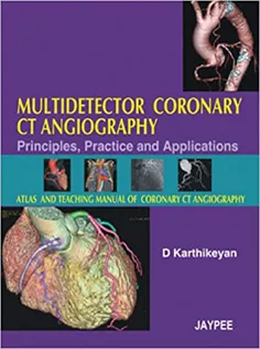 Multidetector Coronary CT Angiography