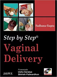 Step by Step Vaginal Delivery