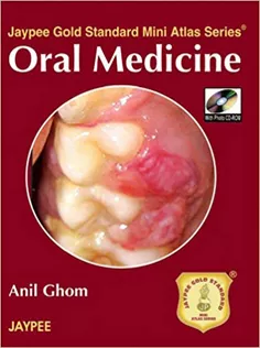 Oral Medicine with Photo