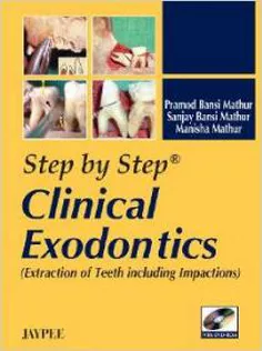 Step by Step Clinical Exodontics