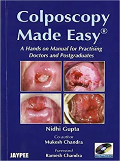 Colposcopy Made Easy