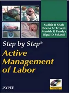 Active Management of Labor Step By Step