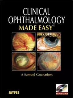 Clinical Ophthalmology Made Easy