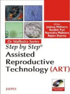 Step By Step Assisted Reproductive Technology