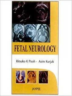 Fetal Neurology