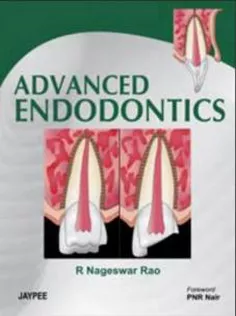 Advanced Endodontics