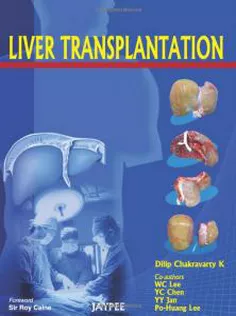 Liver Transplantation1