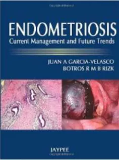 Endometriosis: Current Management and Future Trends