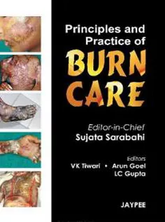 Principles And Practice Of Burn Care
