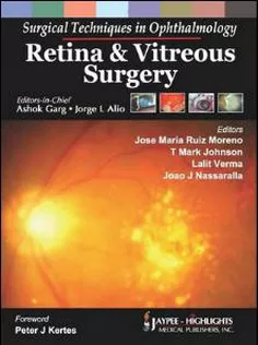 Surgical Techniques In Ophthalmology Retina And Vitreous Surgery
