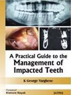 A Practical Guide To The Management Of Impacted Teeth