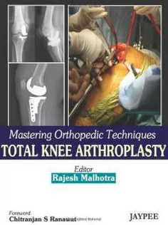Mastering Orthopedic Techniques Total Knee Arthroplasty