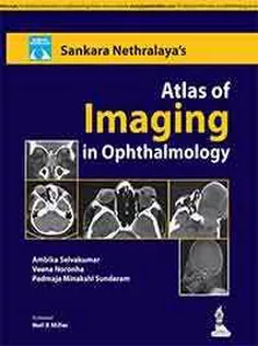 Sankara Nethralaya's Atlas of Imaging in Ophthalmology
